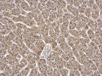 Anti-ETFA antibody used in IHC (Paraffin sections) (IHC-P). GTX114392