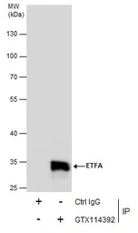 Anti-ETFA antibody used in Immunoprecipitation (IP). GTX114392