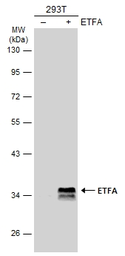 Anti-ETFA antibody used in Western Blot (WB). GTX114392