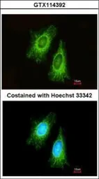 Anti-ETFA antibody used in Immunocytochemistry/ Immunofluorescence (ICC/IF). GTX114392