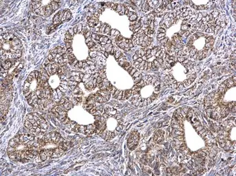 Anti-ETFA antibody used in IHC (Paraffin sections) (IHC-P). GTX114392