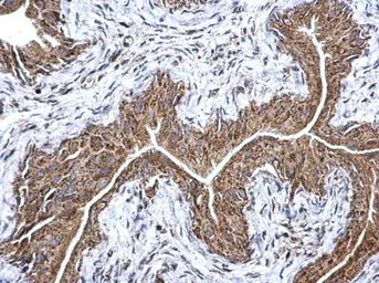 Anti-ETFA antibody used in IHC (Paraffin sections) (IHC-P). GTX114392