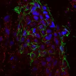 Anti-ETFA antibody used in Immunohistochemistry (IHC). GTX114392