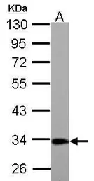 Anti-ETFA antibody used in Western Blot (WB). GTX114392