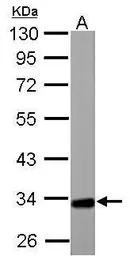 Anti-ETFA antibody used in Western Blot (WB). GTX114392