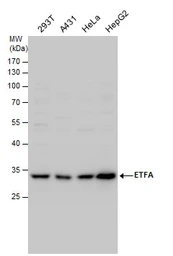 Anti-ETFA antibody used in Western Blot (WB). GTX114392