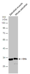 Anti-ETFA antibody used in Western Blot (WB). GTX114392