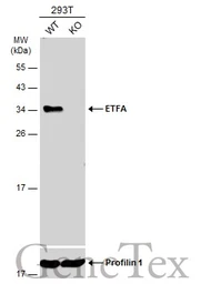 Anti-ETFA antibody used in Western Blot (WB). GTX114392