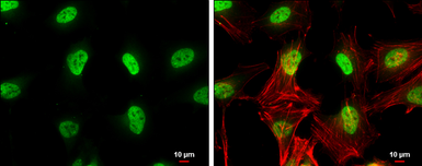 Anti-ERM antibody used in Immunocytochemistry/ Immunofluorescence (ICC/IF). GTX114394