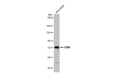 Anti-ERM antibody used in Western Blot (WB). GTX114394