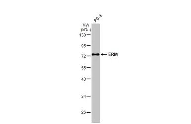 Anti-ERM antibody used in Western Blot (WB). GTX114394