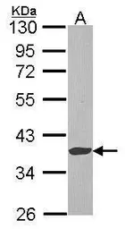 Anti-EXTL2 antibody [N2C3] used in Western Blot (WB). GTX114395