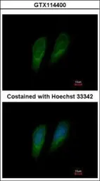 Anti-FAH antibody used in Immunocytochemistry/ Immunofluorescence (ICC/IF). GTX114400