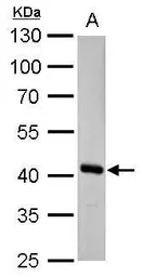 Anti-FAH antibody used in Western Blot (WB). GTX114400