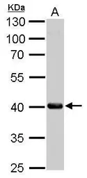 Anti-FAH antibody used in Western Blot (WB). GTX114400