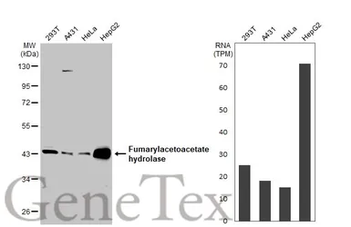 Anti-FAH antibody used in Western Blot (WB). GTX114400
