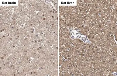 Anti-FAH antibody used in IHC (Paraffin sections) (IHC-P). GTX114400