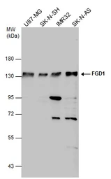Anti-FGD1 antibody used in Western Blot (WB). GTX114404