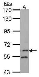 Anti-FMO1 antibody [N2C1], Internal used in Western Blot (WB). GTX114412