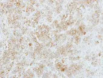 Anti-FMO5 antibody [N1N3] used in IHC (Paraffin sections) (IHC-P). GTX114414