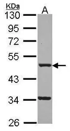 Anti-FNTB antibody [N1C1] used in Western Blot (WB). GTX114415