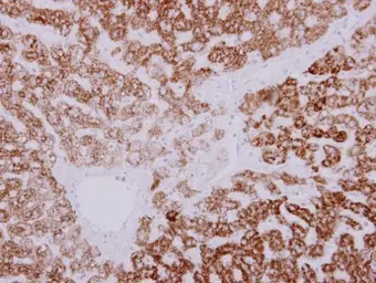 Anti-GARS antibody [N3C2], Internal used in IHC (Paraffin sections) (IHC-P). GTX114421