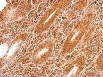 Anti-GARS antibody [N3C2], Internal used in IHC (Paraffin sections) (IHC-P). GTX114421