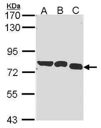 Anti-GARS antibody [N3C2], Internal used in Western Blot (WB). GTX114421
