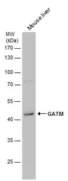 Anti-GATM antibody [N3C3] used in Western Blot (WB). GTX114423