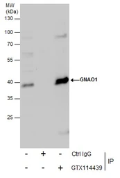 Anti-GNAO1 antibody used in Immunoprecipitation (IP). GTX114439