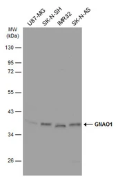 Anti-GNAO1 antibody used in Western Blot (WB). GTX114439