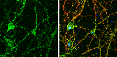 Anti-GNAO1 antibody used in Immunocytochemistry/ Immunofluorescence (ICC/IF). GTX114439