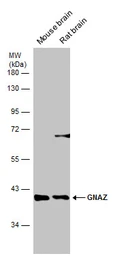 Anti-GNAZ antibody [N1C1] used in Western Blot (WB). GTX114441