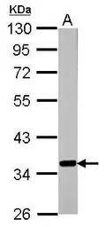 Anti-GNB2 antibody [N2C3] used in Western Blot (WB). GTX114443