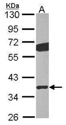 Anti-GNB2 antibody [N2C3] used in Western Blot (WB). GTX114443