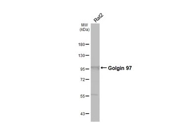 Anti-Golgin 97 antibody [C2C3], C-term used in Western Blot (WB). GTX114445