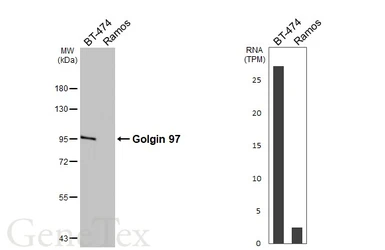 Anti-Golgin 97 antibody [C2C3], C-term used in Western Blot (WB). GTX114445