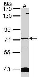 Anti-GUCY1A3 antibody [C1C3] used in Western Blot (WB). GTX114458