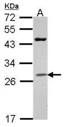 Anti-Granzyme H antibody [N2C3] used in Western Blot (WB). GTX114460