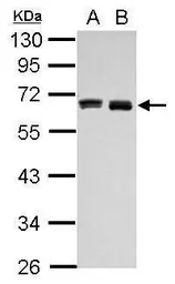 Anti-HAS3 antibody used in Western Blot (WB). GTX114465