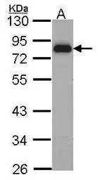 Anti-HCLS1 antibody [N1N3] used in Western Blot (WB). GTX114467