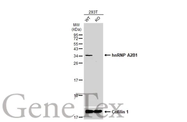 Anti-hnRNP A2B1 antibody used in Western Blot (WB). GTX114475