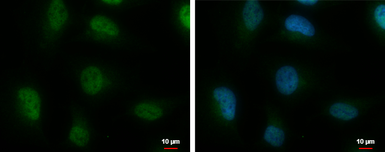 Anti-hnRNP A2B1 antibody used in Immunocytochemistry/ Immunofluorescence (ICC/IF). GTX114475