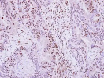 Anti-hnRNP A2B1 antibody used in IHC (Paraffin sections) (IHC-P). GTX114475