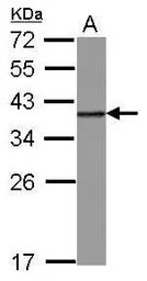 Anti-hnRNP A2B1 antibody used in Western Blot (WB). GTX114475