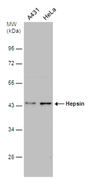Anti-Hepsin antibody used in Western Blot (WB). GTX114479