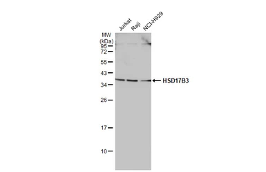 Anti-HSD17B3 antibody used in Western Blot (WB). GTX114480