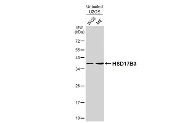 Anti-HSD17B3 antibody used in Western Blot (WB). GTX114480