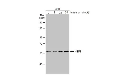 Anti-HSF2 antibody [N1N3] used in Western Blot (WB). GTX114481