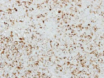 Anti-ICA1 antibody [N1N3] used in IHC (Paraffin sections) (IHC-P). GTX114483